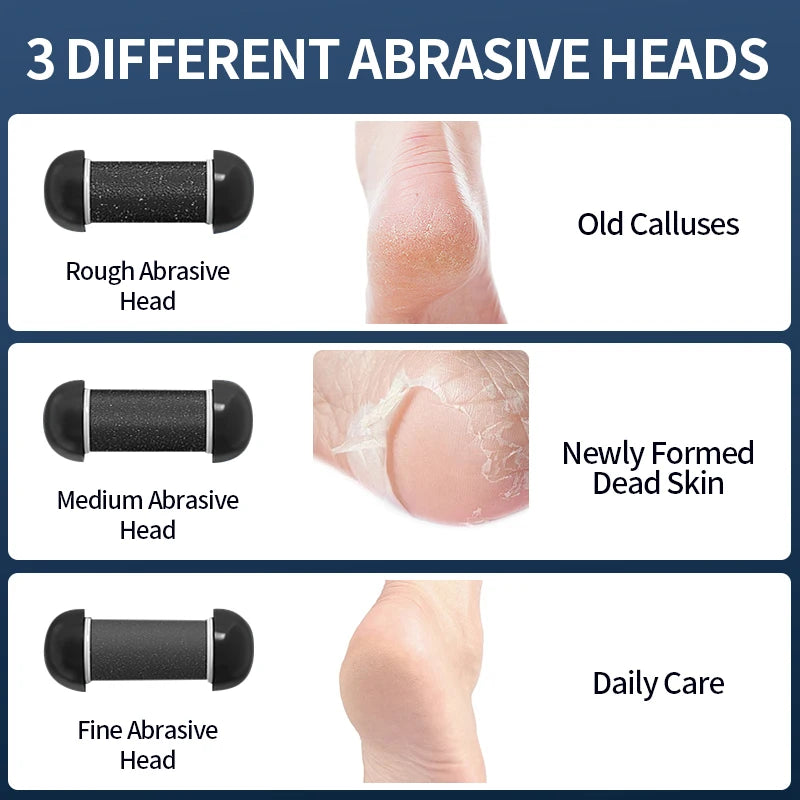 USB Powered Electric Foot Grinder Callus Remover Rechargeable with Adjustable Speeds for Men & Women's Pedicure Care