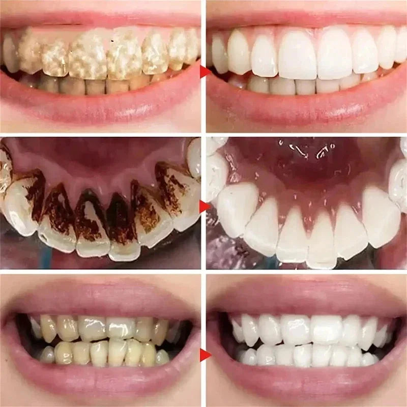 2026 Bestselling Whitening Toothpaste Say Goodbye To Yellow Teeth Oral Hygiene Cleaning and Teeth Care Tool