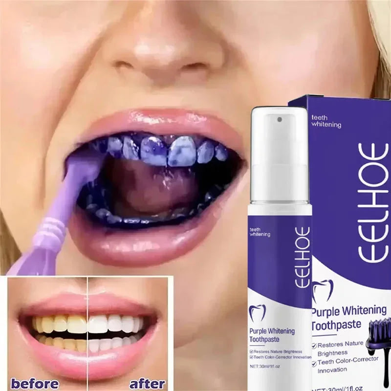 2026 Bestselling Whitening Toothpaste Say Goodbye To Yellow Teeth Oral Hygiene Cleaning and Teeth Care Tool