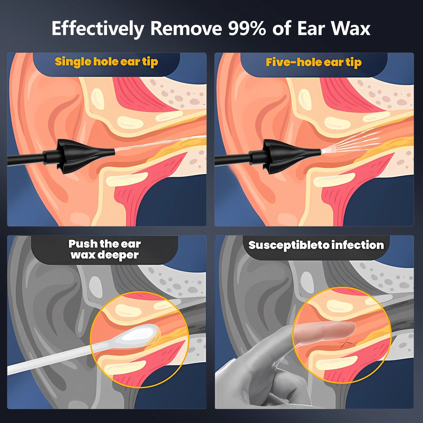 Ear Wax Removal Tool, Electric Ear Irrigation Flushing System, Water Powered with 4 Pressure Modes,8 Reusable Replacement Tips