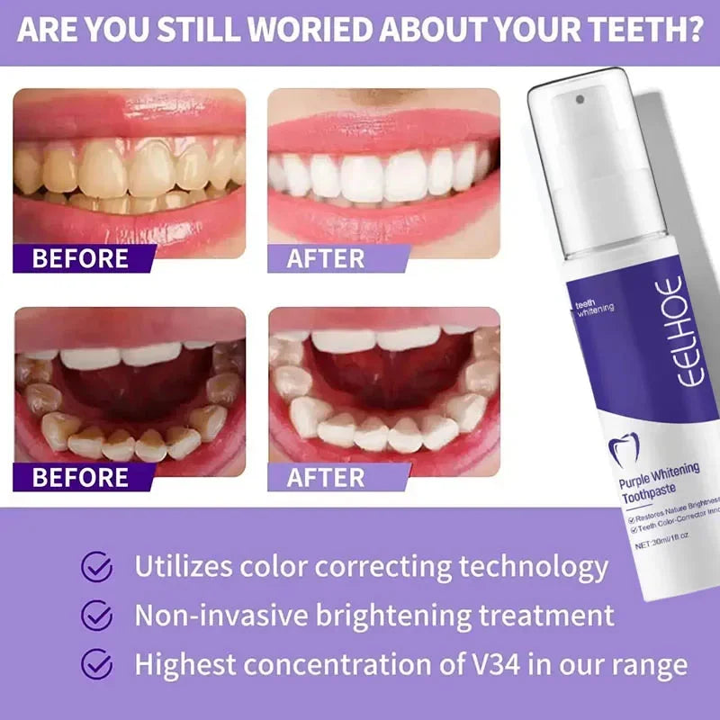 2026 Bestselling Whitening Toothpaste Say Goodbye To Yellow Teeth Oral Hygiene Cleaning and Teeth Care Tool