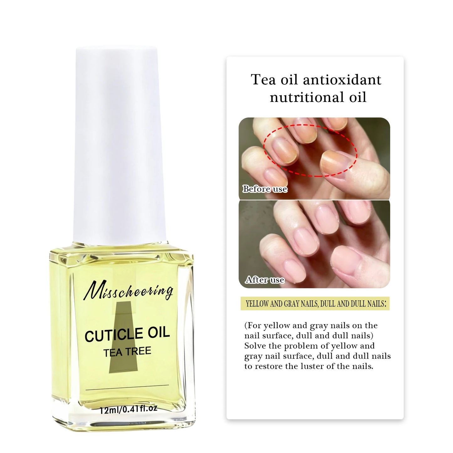 12ml Nails Growth Promoting Nutrient Oil For Repairing Soft And Thin Layered Nails, Nail layering High Quality Nail Care Oil