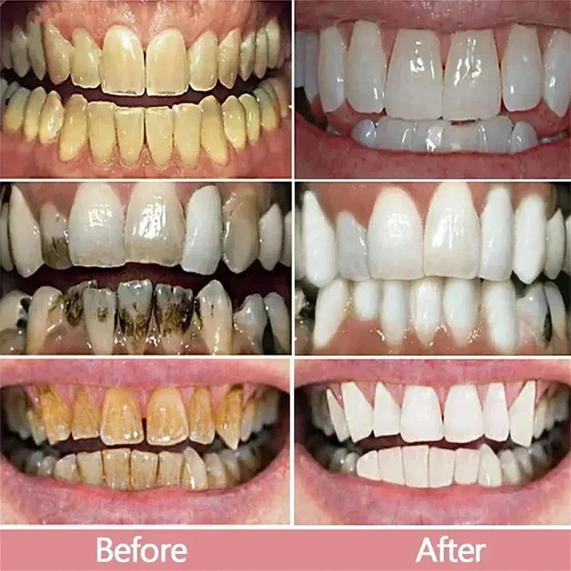 2026 Bestselling Whitening Toothpaste Say Goodbye To Yellow Teeth Oral Hygiene Cleaning and Teeth Care Tool