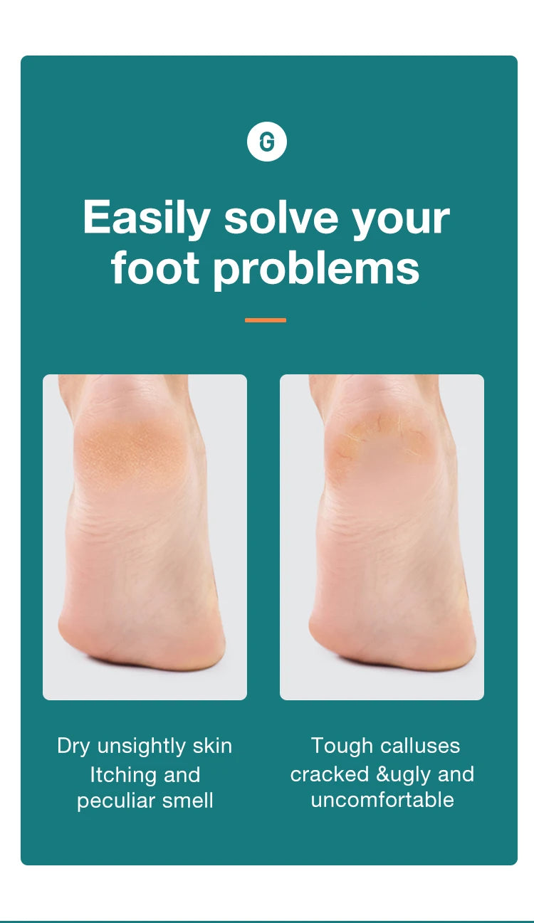 MR.GREEN Foot File Double Sided Callus Remover For Dead Skin Professional Pedicure Tools Callous Scraper Foot Sander Heel Filer