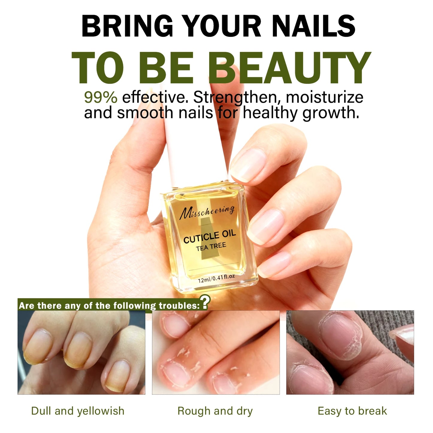 12ml Nails Growth Promoting Nutrient Oil For Repairing Soft And Thin Layered Nails, Nail layering High Quality Nail Care Oil