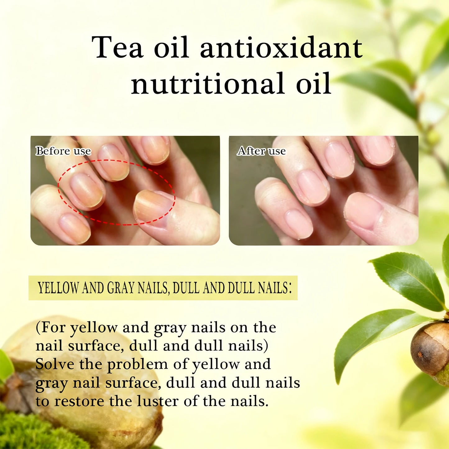 12ml Nails Growth Promoting Nutrient Oil For Repairing Soft And Thin Layered Nails, Nail layering High Quality Nail Care Oil