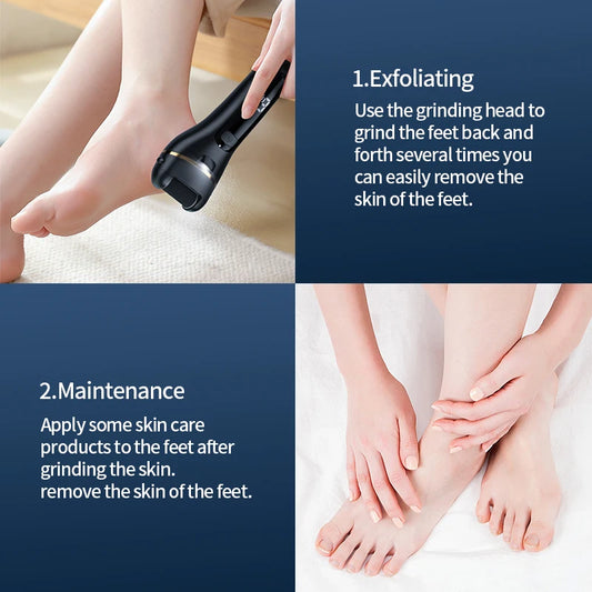 USB Powered Electric Foot Grinder Callus Remover Rechargeable with Adjustable Speeds for Men & Women's Pedicure Care