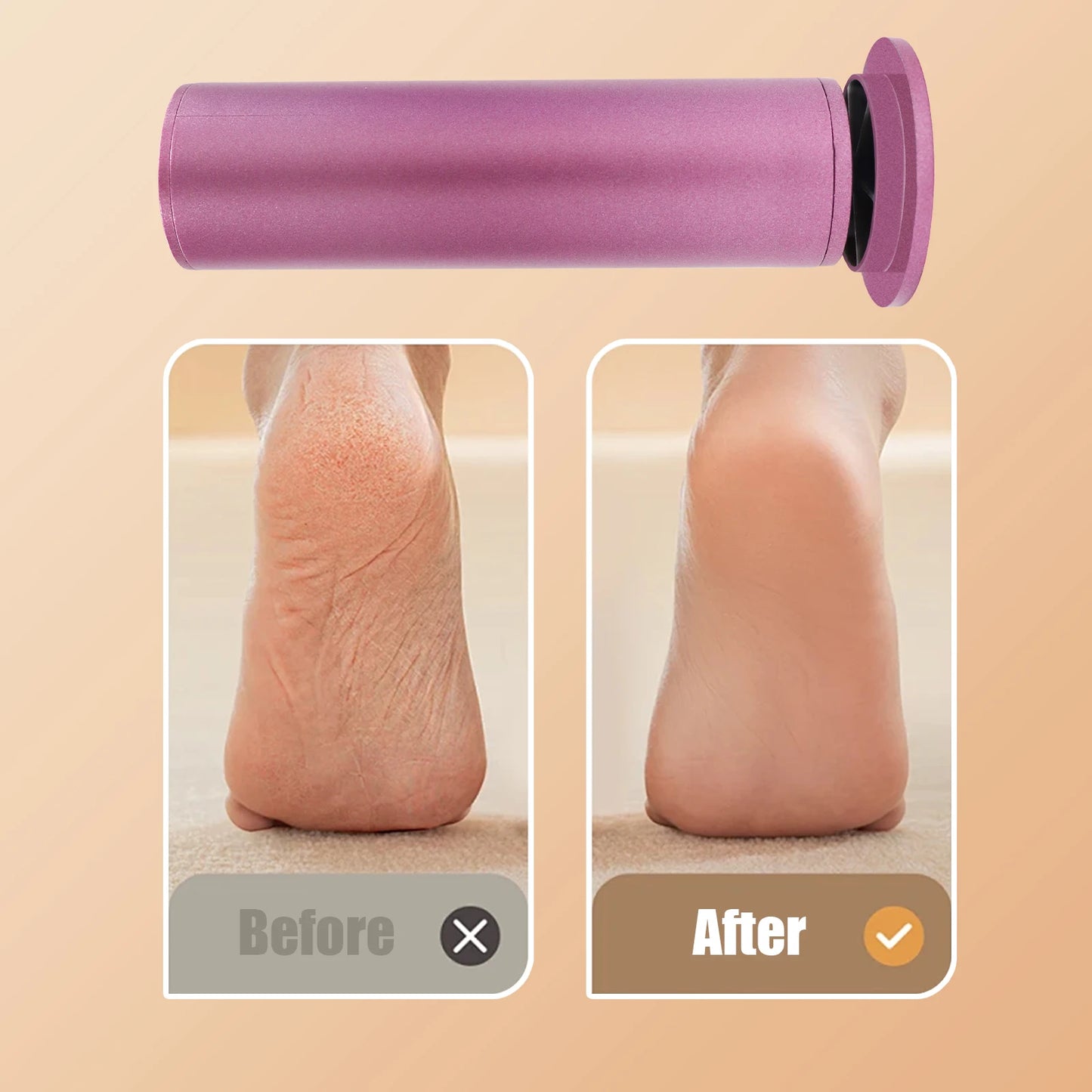 Electric adjustable speed foot callus remover pedicure tool manicure pedicure suit dead skin callus