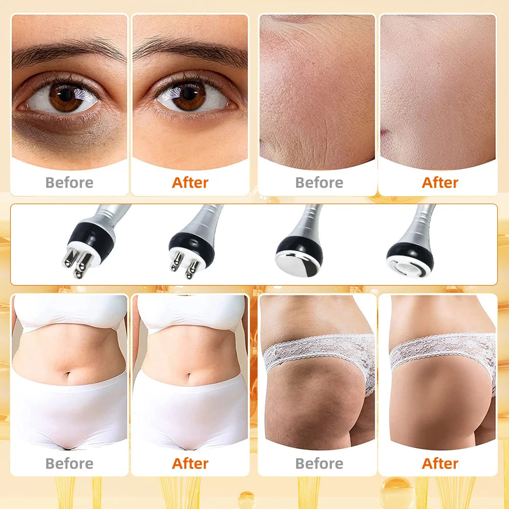 Ultrasonic Cavitation Body Slimming Machine With Facial Massage